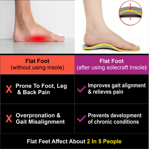 Solecraft Arch Support   Insole (Rigid support)